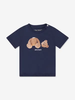 Balloon Sleeve Tops
